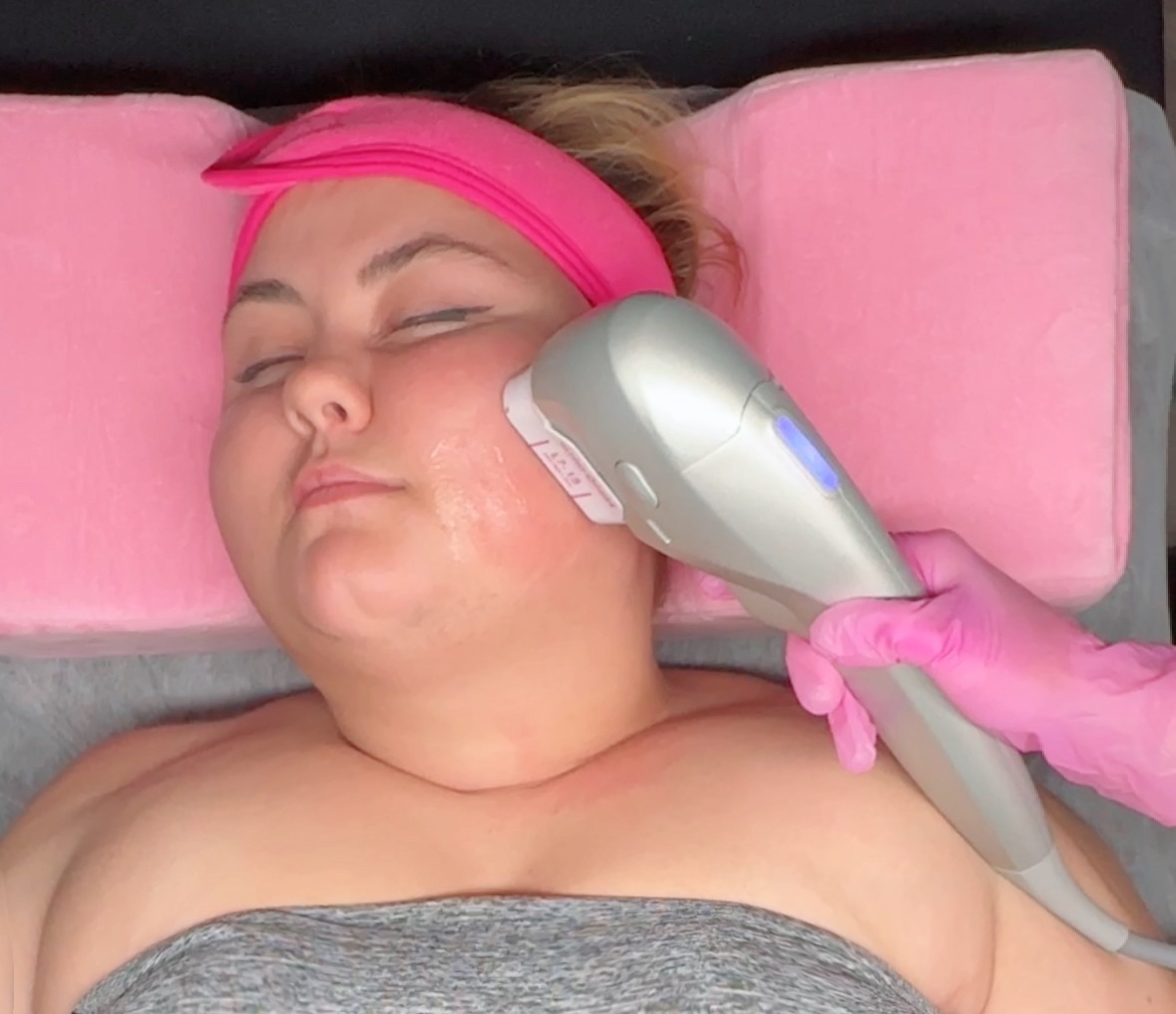 HIFU machine on woman's face